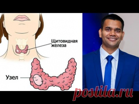 Щитовидка придёт в норму, избавитесь от узлов/киста на Щитовидной железе