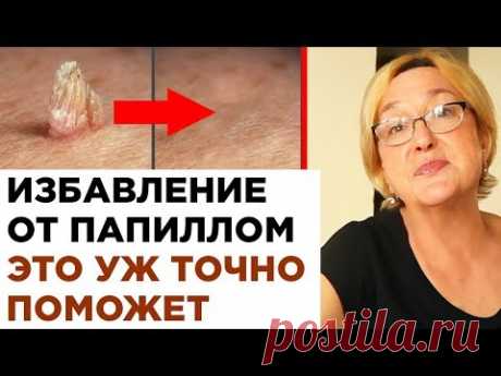 Избавление от папиллом это уж точно поможет