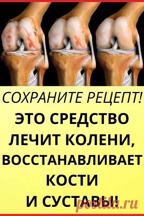 Сохраните рецепт! Это средство лечит колени, восстанавливает кости и суставы!