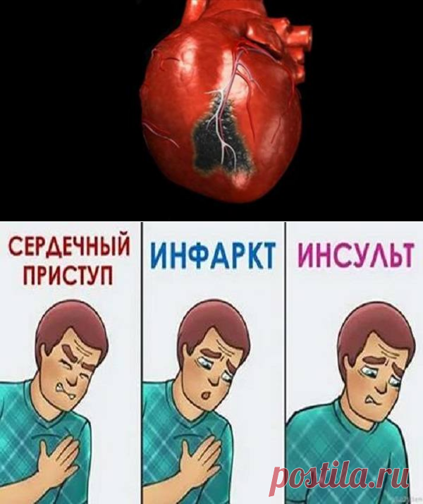Признаки инфаркта, при которых нужно звонить в скорую — Journal women❜s