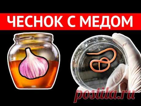 Принимала смесь ЧЕСНОКА С МЕДОМ НАТОЩАК, вот что вышло через 7 дней. Я ШОКИРОВАНА!