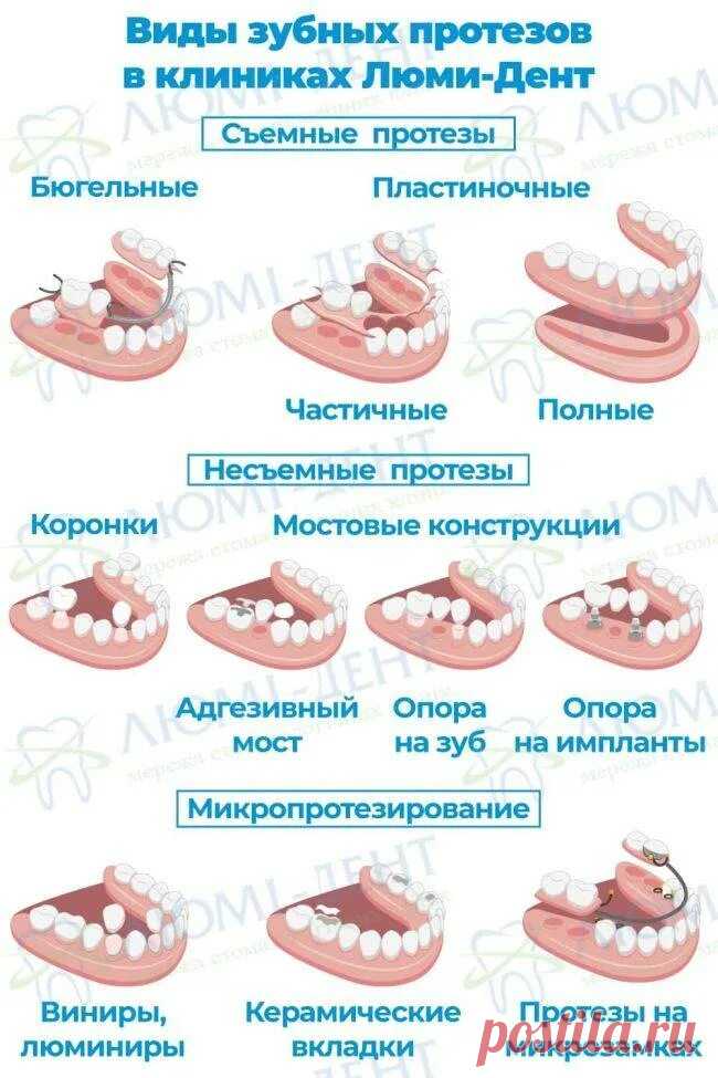 таблицы цен на съемные протезы из металлокерамики цена: 2 тыс изображений найдено в Яндекс Картинках