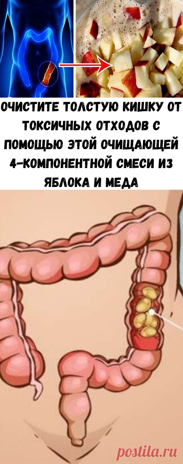 Надо очищать кишечник. Вычещение толстой кишки. Очистить толстый кишечник.