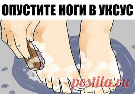 Опустите ноги в яблочный уксус — и болезни уйдут! Сами в шоке!! Это просто восхитительно!

Одной из моих целей на этот год была такая: отказаться от традиционных коммерческих косметологических средств в пользу натуральных продуктов и изобретений. 
И вот что я выяснила: оказывается, одно из самых мощных и нетактичных средств — это яблочный уксус. Найти его можно в любом продуктовом магазине, а преимущества, которые он дает, просто фантастические! 
Нефильтрованный, непастери...