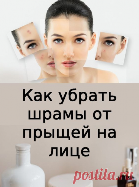 Как избавиться от шрамов и рубцов на лице на 100%
Как убрать шрамы после прыщей народными и аптечными средствами.