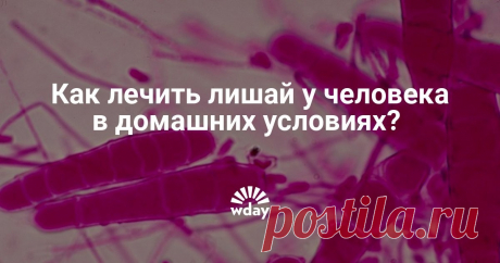 Как лечить лишай у человека в домашних условиях? Лишай у человека: лечение в домашних условиях, Читайте о методах лечения лишая у человека в нашей статье.