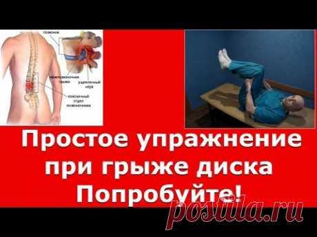 Как вылечить  грыжу диска легко и без уколов!