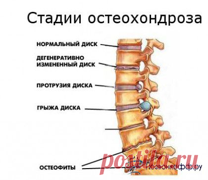 Здравотдел. Упражнения при остеохондрозе, сутулости, для коленных суставов
