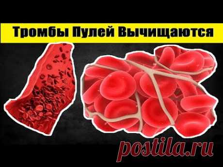 Холестерин и Тромбы Пулей Вычищаются Из Сосудов! Чудо Рецепт Для Кровообращения Из Этих 10 Продуктов