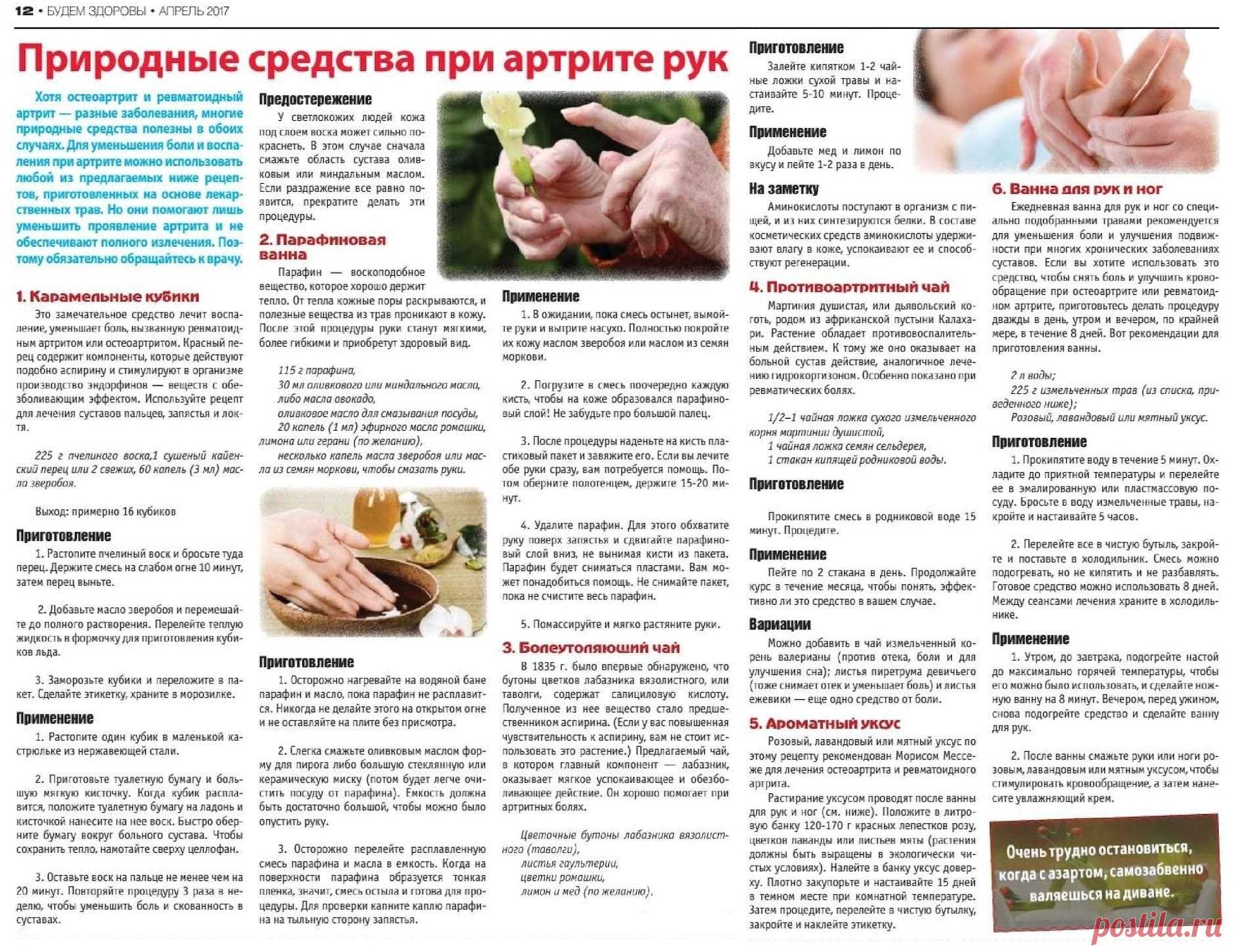 Природные средства при артрите рук