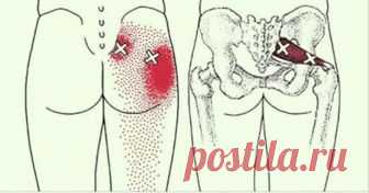 2 трюка, которые разблокируют седалищный нерв и облегчат боль в течение нескольких минут!         2 трюка, которые разблокируют седалищный нерв и облегчат боль в течение нескольких минут!      Эти простые трюки быстро снимут боль! ...