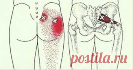 2 трюка, которые разблокируют седалищный нерв и облегчат боль в течение нескольких минут!         2 трюка, которые разблокируют седалищный нерв и облегчат боль в течение нескольких минут!      Эти простые трюки быстро снимут боль! ...