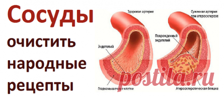 Как очистить сосуды по народным рецептам | Советы целительницы