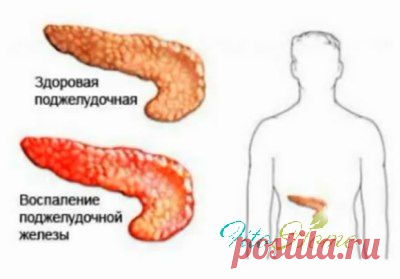 Панкреатит: лечение народными средствами
