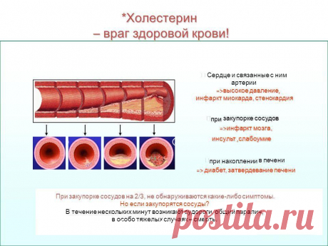 Как Оказалось, Очистить Сосуды От Холестерина Можно Без Врачей И Таблеток!Невероятно!