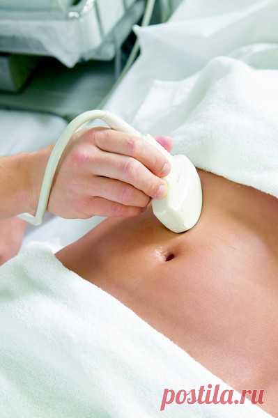 Лечение миомы в Германии, эффективная диагностика и консервативная терапия