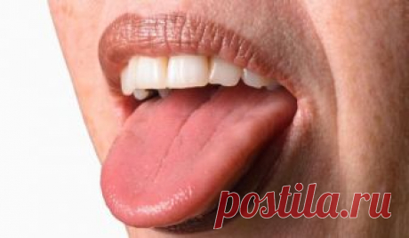 3 ВЕЩИ, КОТОРЫЕ ВАШ ЯЗЫК ПЫТАЕТСЯ РАССКАЗАТЬ О ВАШЕМ ЗДОРОВЬЕ