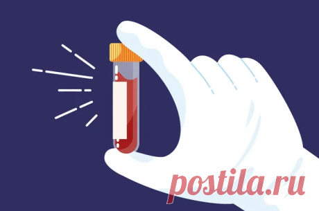 Как определить болезнь Альцгеймера по анализу крови / Будьте здоровы