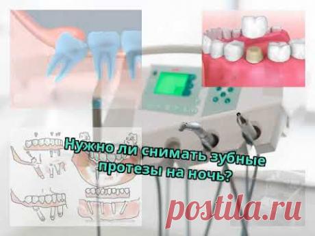 Нужно ли снимать зубные протезы на ночь?