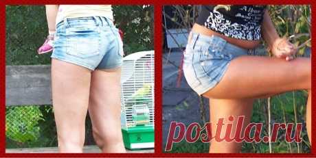 Средства в борьбе с целлюлитом и растяжками - «Как я смогла УБРАТЬ ЦЕЛЛЮЛИТ в домашних условиях и предотвратить растяжки /моя программа похудения и МНОГО ФОТО ДО-ПОСЛЕ + бонус - как сделать домашний крем от растяжек при беременности. Рецепт:)» | Отзывы покупателей