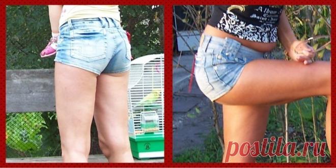 Средства в борьбе с целлюлитом и растяжками - «Как я смогла УБРАТЬ ЦЕЛЛЮЛИТ в домашних условиях и предотвратить растяжки /моя программа похудения и МНОГО ФОТО ДО-ПОСЛЕ + бонус - как сделать домашний крем от растяжек при беременности. Рецепт:)» | Отзывы покупателей