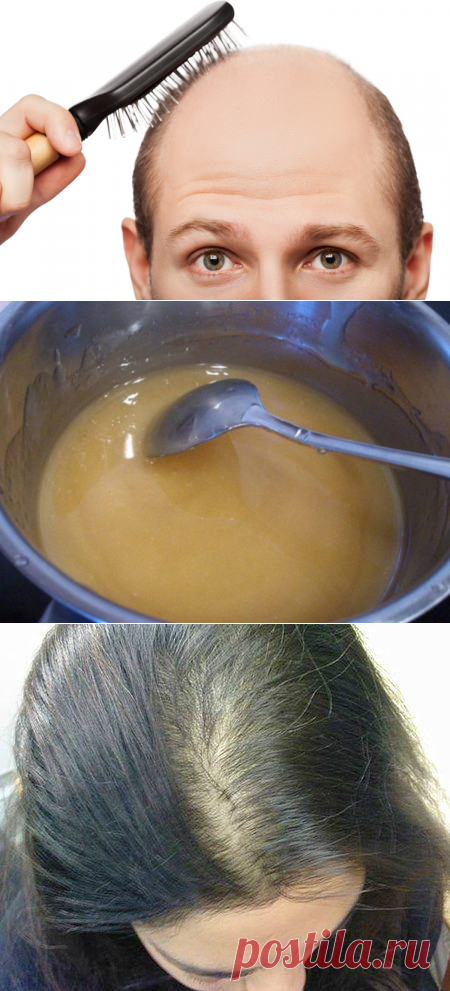 Как отрастить выпавшие волосы дома натуральным средством
