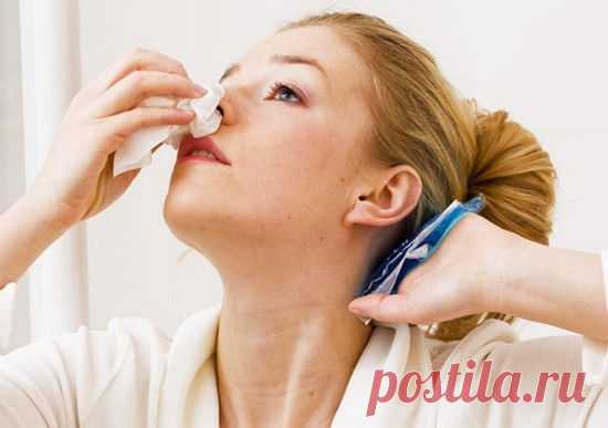 Как остановить кровь из носа правильно и быстро