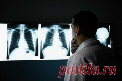 Названы способы снизить риск развития рака легкого