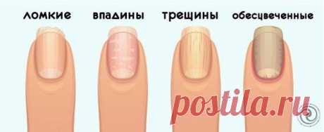 На какие проблемы со здоровьем может указывать состояние ваших ногтей?