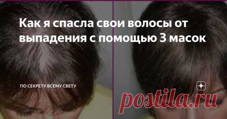 Как я спасла свои волосы от выпадения с помощью 3 масок И это не просто кричащий заголовок для поста, эти маски действительно очень крутые, проверенные временем.
Знаю по себе, что проблема выпадения волос это действительно проблема, которая стоит внимания. Ни один шампунь с сульфатом или без, ни одна магазинная маска не помогли мне справиться с выпадением.
Испробовав на себе всевозмножные средства из масс-маркета я решила попробовать народные методы.