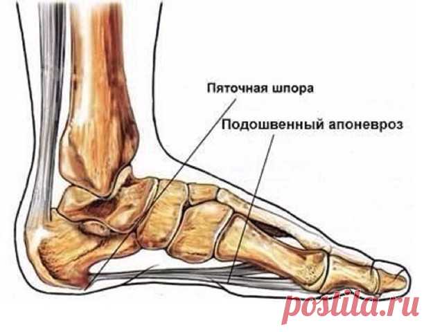Лечение пяточной шпоры с помощью народных средств 

Народный рецепт №1: лечение картофелем 

Возьмите 7-8 картофелин средней величины и сварите их в “мундире”. После этого с помощью насадки на миксере для приготовления пюре (или вручную) тщательно растолките эти картофелины, добавляя небольшое количество керосина с таким расчетом, чтобы получилось очень нежное пюре. 
Затем выложите получившееся пюре в тазик и погрузите в него больные ноги с пяточной шпорой. Держите ноги в ...