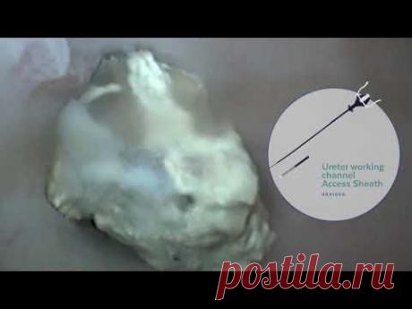 Биопси Медикал - медицинское оборудование и инструменты