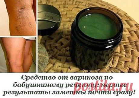 Средство от варикоза по бабушкиному рецепту: первые результаты заметны почти сразу!