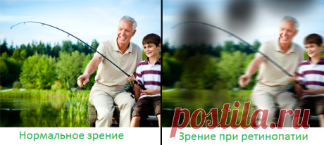 Как сохранить зрение при диабете