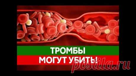 То, что каждый должен знать и помнить о тромбозе | тромбоз | Яндекс Дзен