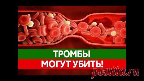 То, что каждый должен знать и помнить о тромбозе | тромбоз | Яндекс Дзен