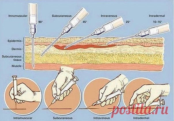 (64) Одноклассники