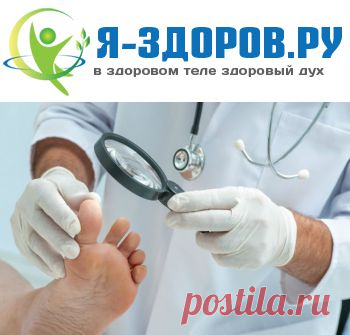 Топ-8 Лучших Народных Средств Лечения Грибка Ногтей На Ногах