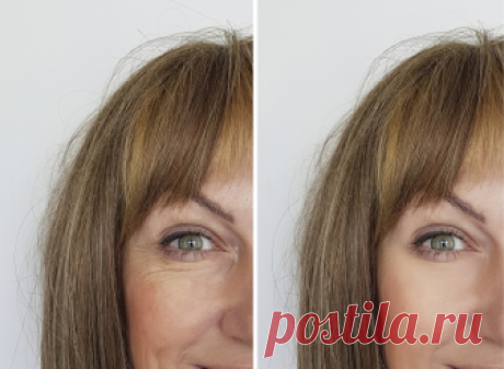 Свежим и подтянутым лицо сделает гепариновая мазь