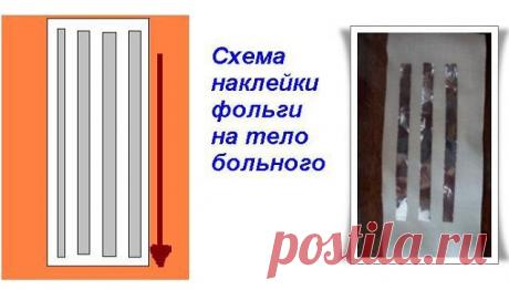 Лечение при помощи алюминиевой фольги | Правила здоровья и долголетия