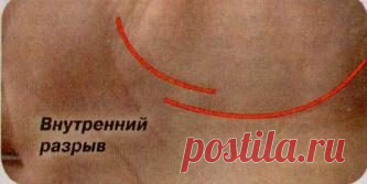 Что значит разрыв линии жизни на руке? / Мистика