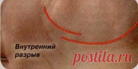 Что значит разрыв линии жизни на руке? / Мистика