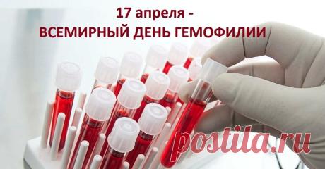 "В день гемофилии желаем вам силы,
Чтоб жизнь была радостной, очень красивой.
Пусть факторы крови всегда будут в норме,
И будете вы в замечательной форме! Открытки на Всемирный день гемофилии!"