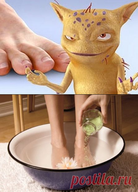 Грибок-то соли боится… | Всегда в форме!