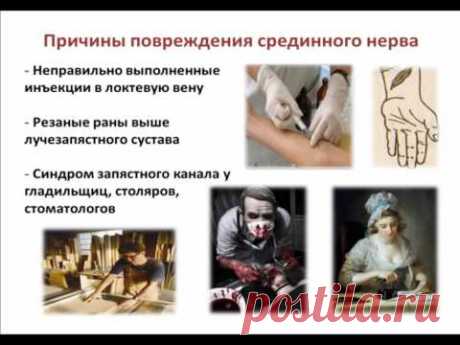 Невропатия периферических нервов. Клиника, основы диагностики и лечения.