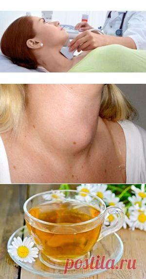 Зоб щитовидной железы - что это такое? Симптомы и лечение.