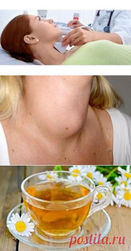 Зоб щитовидной железы - что это такое? Симптомы и лечение.