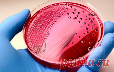 The size of the global market for sepsis diagnostics was estimated at USD 770.4 million in 2022 and is anticipated to increase from USD 840.5 million in 2023 to USD 1,603.3 million by 2030, at a CAGR of 9.7%.