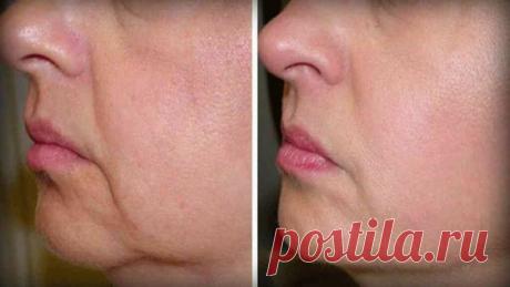 5 лучших природных средств для устранения провисание кожи и морщин! Они вернут вашей коже упругость и молодость! Уже после первого применения вы заметите результаты, а через неделю их заметят все! Большинство людей, как правило, не хотят стареть. И поэтому уделяют большое внимание уходу за кожей. Недостаток питательных веществ или контакт с большим количеством солнечного света и токсинами может вызвать преждевременное  старение кожи. Всегда пейте достаточное количество вод...