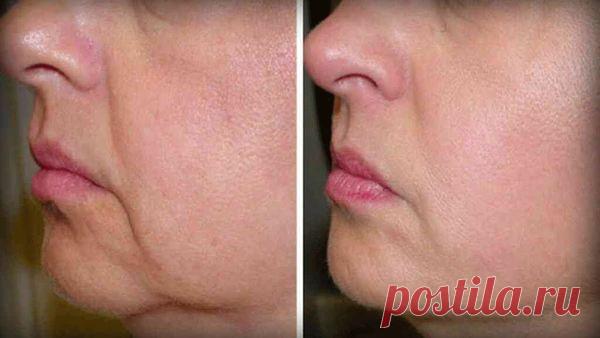 5 лучших природных средств для устранения провисание кожи и морщин! Они вернут вашей коже упругость и молодость! Уже после первого применения вы заметите результаты, а через неделю их заметят все! Большинство людей, как правило, не хотят стареть. И поэтому уделяют большое внимание уходу за кожей. Недостаток питательных веществ или контакт с большим количеством солнечного света и токсинами может вызвать преждевременное  старение кожи. Всегда пейте достаточное количество вод...